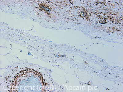 IHC image of ab83739 staining in Hu Aorta formalin fixed paraffin embedded tissue section, performed on a Leica BondTM system using the standard protocol F. The section was pre-treated using heat mediated antigen retrieval with sodium citrate buffer (pH6, epitope retrieval solution 1) for 20 mins. The section was then incubated with ab83739, 5µg/ml, for 15 mins at room temperature and detected using an HRP conjugated compact polymer system. DAB was used as the chromogen. The section was then counterstained with haematoxylin and mounted with DPX.For other IHC staining systems (automated and non-automated) customers should optimize variable parameters such as antigen retrieval conditions, primary antibody concentration and antibody incubation times.