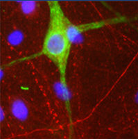 Ab39374 staining human peripherin in neonatal rat cortical neurons cultured for 14-21 days by ICC/IF.