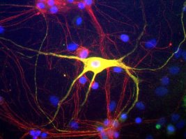 ab106276, at 1/2000, staining Peripherin (green channel) and Neurofilament alpha-internexin/NF66 (green channel) in Rat mixed neuron/glial cultures by Immunofluorescence. These cultures contain mostly neurons which are rich in alpha internexin, and a subgroup which have a large amount of peripherin also, such as the prominent cell in the middle of the micrograph. Since this cell expresses large amounts of peripherin and alpha internexin, the green and red signals superimpose to produce a golden cell. Blue is a DNA stain.