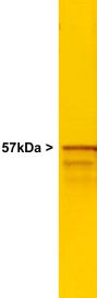 Anti-Peripherin antibody - nociceptive neuron marker (ab4666) at 1/20000 dilution + Whole rat brain stem homogenateObserved band size : 57 kDa (why is the actual band size different from the predicted?)Additional bands at : 48 kDa. We are unsure as to the identity of these extra bands.