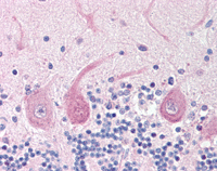 ab115617, at 1/400 dilution, staining PERK in Formalin-fixed, Paraffin-embedded Human Brain Cerebellum tissue by Immunohistochemistry followed by biotinylated secondary antibody, alkaline phosphatase-streptavidin and chromogen.