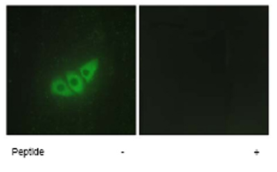 Immunofluorescence analysis of HepG2 cells using ab65142 at a 1/500-1/1000 dilution. Left image untreated. Right image treated with immunising peptide.
