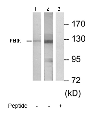 All lanes : Anti-PERK antibody (ab65142) at 1/500 dilutionLane 1 : Extracts from Hela cellsLane 2 : Extracts from HepG2 cellsLane 3 : Extracts from HepG2 cells, plus immunising peptide
