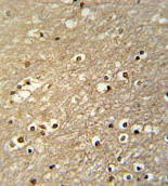 Immunohistochemical analysis of paraffin-embedded Human brain tissue labeling TFAP4 with ab175081 at 1/50 dilution followed by peroxidase conjugation of the secondary antibody and DAB staining.