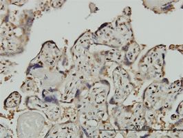 TFII I antibody (ab55200) used in immunohistochemistry at 3ug/ml on formalin fixed and paraffin embedded human placenta.