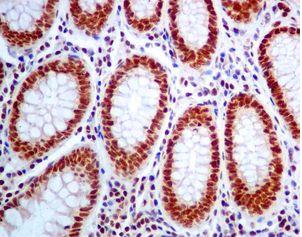 ab129025, at 1/100 dilution staining TFII I in formalin fixed paraffin embedded Human colon tissue by immunohistochemistry