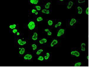 ab129025, at 1/100 dilution, staining TFII I in Hela cells by immunofluorescence