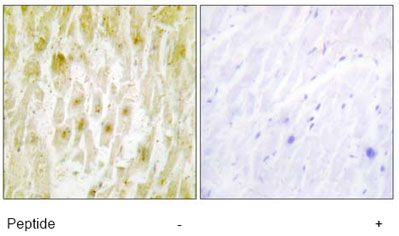 ab64932, at a 1/50 dilution, staining Human TFIIE beta in paraffin-embedded heart tissue, by Immunohistochemistry, with (+) or without (-) immunising peptide.