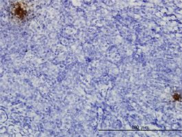 TFPI2 antibody (ab56333) used in immunohistochemistry at 1ug/ml on formalin fixed and paraffin embedded human tonsil.