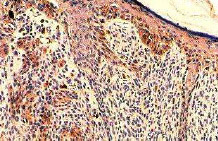 Immunohistochemical characterization of the anti-TGF-α monoclonal antibody ab9578 on human melanoma.