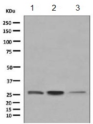 All lanes : Anti-TGF beta induced factor 2 antibody [EPR5655(2)] (ab155948) at 1/1000 dilutionLane 1 : Human fetal kidney tissue lysateLane 2 : HeLa cell lysateLane 3 : Human ovary cancer tissue lysateLysates/proteins at 10 µg per lane.