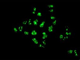 Immunofluorescence analysis of HeLa cells, labeling TGF beta induced factor 2 using ab155948 at 1/250 dilution.