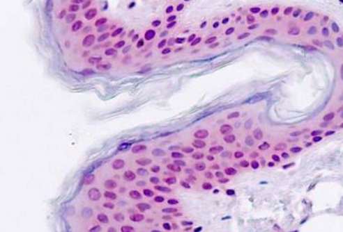 Immunohistochemical analysis of formalin-fixed, paraffin-embedded Human skin tissue labeling TGF beta induced factor 2 with ab190152 at 5 µg/ml.