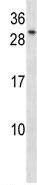 Anti-TGF beta induced factor 2 antibody (ab123740) at 1/100 dilution + MDA-MB453 cell line lysates at 35 µg