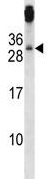 Anti-TGF beta induced factor 2 antibody (ab123740) at 1/100 dilution + Mouse Neuro 2a cell line lysates at 35 µg