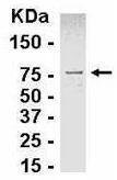 Anti-TGF beta induced factor 2 antibody (ab26199) at 1/2000 dilution + E coli derived fusion protein (0.5ug)SecondaryGoat anti IgY HRP at 1/1000 dilution