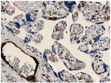 ab51871 at 1/200 dilution staining TGF beta Receptor I in human placental tissue section by Immunohistochemistry (Formalin/PFA fixed paraffin-embedded sections).