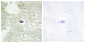 ab111564, at 1/50 dilution, staining TGF beta Receptor II in paraffin-embedded Human brain tissue by Immunohistochemistry, in the presence (right panel) or absence (left panel) of immunising peptide.