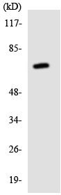 Anti-TGF beta Receptor II antibody (ab138248) at 1/500 dilution + HT-29 cell lysate at 30 µg