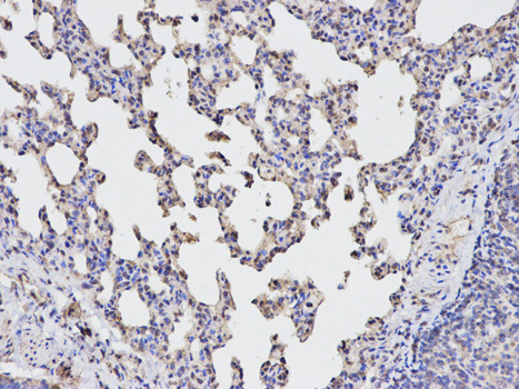 Immunohistochemistry (Formalin/PFA-fixed paraffin-embedded sections) analysis of rat lung tissue labelling TGFBI with ab189778 at 1/100. Magnification: 200x.