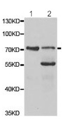 All lanes : Anti-TGFBI antibody (ab189778) at 1/500 dilutionLane 1 : Mouse lung cell line extractLane 2 : Mouse liver cell line extract