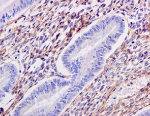 Immunohistochemical analysis of paraffin-embedded Human uterus tissue labeling TGFBI using ab170874 at a 1/100 dilution