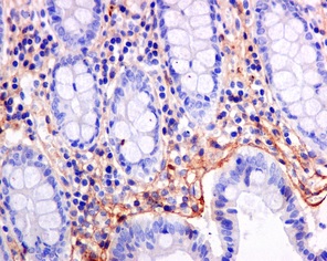 Immunohistochemical analysis of paraffin-embedded Human colon tissue labeling TGFBI using ab170874 at a 1/100 dilution