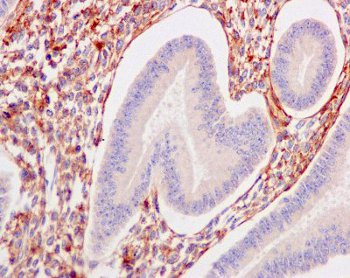 Immunohistochemical analysis of paraffin-embedded Human uterus tissue labeling TGFBI with ab169771 at 1/250 dilution.