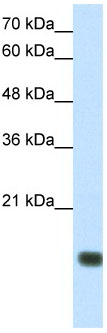 Anti-TGIF2LY antibody (ab66386) at 1.25 µg/ml + HepG2 cell lysate at 10 µgSecondaryHRP conjugated anti-Rabbit IgG at 1/50000 dilution