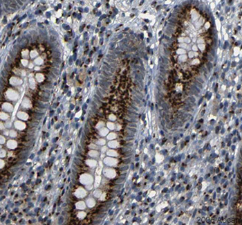 Image courtesy of Human Protein Atlasab16052 staining TGN46 in Human appendix.The paraffin embedded human skin tissue was incubated with ab16052 (1/50 dilution) for 30 mins at room temperature. Antigen retrieval was performed by heat induction in citrate buffer pH 6. Ab16052 was tested in a tissue microarray (TMA) containing a wide range of normal and cancer tissues as well as a cell microarray consisting of a range of commonly used, well characterised human cell lines.Further results for this antibody can be found at www.proteinatlas.org