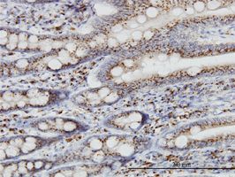 TGN46 antibody (ab56726) used in immunohistochemistry at 3ug/ml on formalin fixed and paraffin embedded human small Intestine.