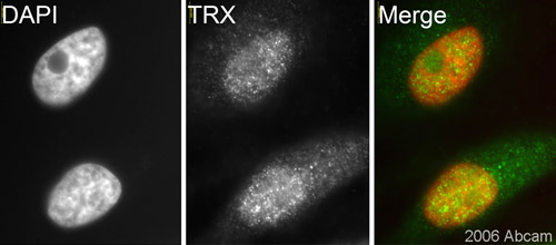 ab26320, at 1/200 dilution, staining human TRX in assynchronous HeLa cells by ICC/IF.See Abreview