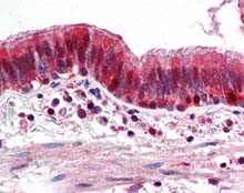 Human Lung (formalin-fixed, paraffin-embedded) stained with ab115758 at 1/200 followed by biotinylated goat anti-rabbit IgG secondary antibody, alkaline phosphatase-streptavidin and chromogen.