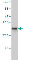 Western blot against tagged recombinant protein immunogen using ab57431 SLC2A4RG antibody at 1ug/ml.