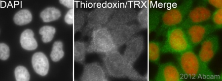 ab133524 (1/200) staining TRX in asynchronous HeLa cells (green). Cells were fixed in methanol and counterstained with DAPI in order to highlight the nucleus (red). For further experimental details please see abreviews.See Abreview