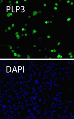 ab56600 staining Thioredoxin domain containing 9 (green) in CHOK1 cells transfected with PhLP3, by Immunocytochemistry/ Immunofluorescence. Cells were fixed with paraformaldehyde, permeabilized by 0.1% Triton X-100 in PBS for 5 min at 4°C, and blocked with 3% BSA in PBS for 20 minutes at room temperature. Samples were incubated with primary antibody (diluted in 3% BSA in PBS) for 1 hour at room temperature. Nuclei were stained with DAPI (blue).