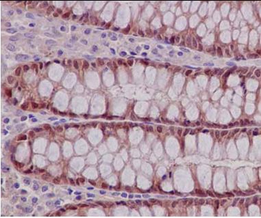 Immunohistochemical analysis of paraffin-embedded Human colon tissue labeling Thioredoxin domain containing 9 with ab185959 at 1/50 dilution followed by pre-diluted HRP-conjugated secondary antibody and counter-stained with Hematoxylin.