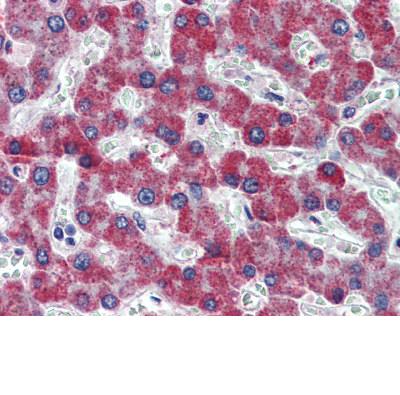ab111976, at 2.5µg/ml, staining Thrombin Receptor in Formalin-fixed, Paraffin-embedded Human Liver tissue by Immunohistochemistry.
