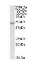 Anti-Thrombin Receptor antibody (ab111976) at 0.5 µg/ml + HeLa lysate (in RIPA buffer) at 35 µgdeveloped using the ECL technique