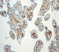 ab109189, at 1/100 dilution, staining Thrombomodulin in Human placenta tissue by Immunohistochemistry.