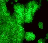 ab109189, at 1/100 dilution, staining Thombomodulin in A431 cells by Immunofluorescence.