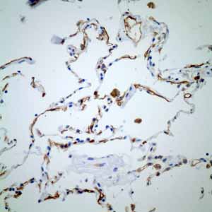 Immunohistochemical analysis of paraffin embedded normal Human lung tissue using ab109189 showing +ve staining.