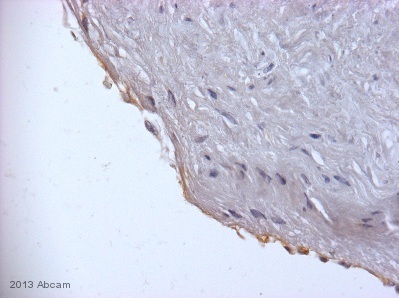 ab109189 staining Thrombomodulin in Human artery tissue sections by Immunohistochemistry (IHC-P - paraformaldehyde-fixed, paraffin-embedded sections). Tissue was fixed with formaldehyde and blocked with 20% serum for 60 minutes at 21°C; antigen retrieval was by heat mediation in a citrate buffer. Samples were incubated with primary antibody (1/200) for 16 hours at 4°C. A Biotin-conjugated Goatanti-rabbit polyclonal (1/200) was used as the secondary antibody.See Abreview