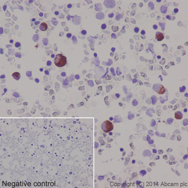 Immunohistochemical analysis of paraffin-embedded Human bone marrow tissue labeling Thrombopoietin with ab196026 at 1/4000 dilution followed by Goat Anti-Rabbit IgG H&L (HRP) (ab97051) at 1/500 dilution and counter-stained with Hematoxylin. (inset: negative control).Note: Cytoplasm staining on human bone marrow tissue was observed.