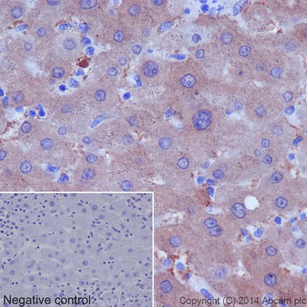 Immunohistochemical analysis of paraffin-embedded Human liver tissue labeling Thrombopoietin with ab196026 at 1/4000 dilution followed by Goat Anti-Rabbit IgG H&L (HRP) (ab97051) at 1/500 dilution and counter-stained with Hematoxylin. (inset: negative control).Note: Cytoplasm staining on human liver tissue was observed.