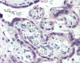 ab85544, at 5µg/ml, staining Thromboxane A2 receptor in formalin-fixed, paraffin-embedded human placenta tissue by Immunohistochemistry.