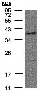 Anti-Thromboxane A2 receptor antibody - N-terminal (ab137607) at 1/500 dilution + Raji whole cell lysate at 30 µg