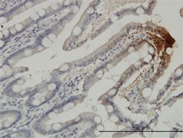 THTPA antibody (ab57728) used in immunohistochemistry at 3ug/ml on formalin fixed and paraffin embedded human small Intestine.