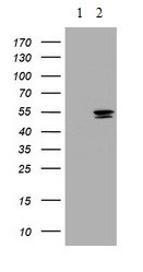 All lanes : Anti-Thymidine Phosphorylase antibody [1E7] (ab140786) at 1/2000 dilutionLane 1 : HEK293T cells transfected with pCMV6-ENTRY control cDNALane 2 : HEK293T cells transfected with pCMV6-ENTRY Thymidine Phosphorylase cDNALysates/proteins at 5 µg per lane.
