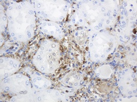 Immunohistochemical analysis of paraffin embedded Human kidney tissue labelling Thymidine Phosphorylase with ab140786 at a 1/150 dilution. 